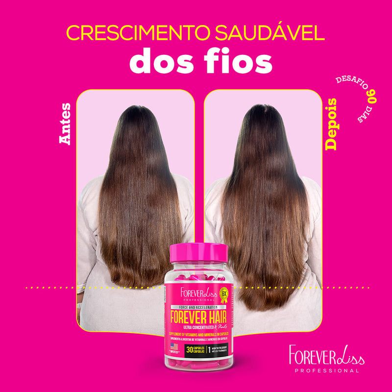 Combo Tratamento 3 Meses Forever Hair Crescimento Capilar